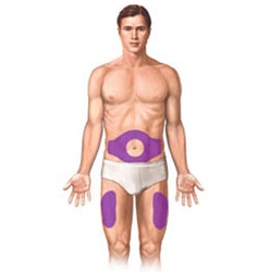 Subcutaneous Injection Sites