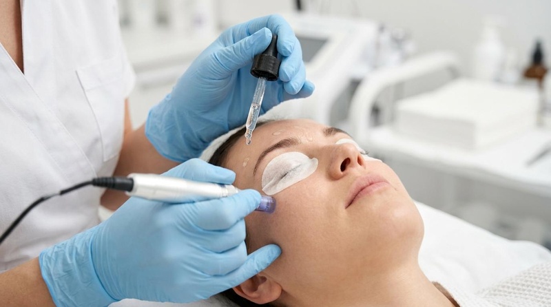 A practitioner performing a motorized dermapen microneedling treatment on a patient cheek while applying serum.